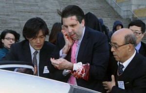 Corée du Sud: L’ambassadeur américain à Séoul attaqué au visage